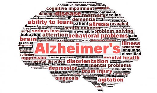 The Progression of Alzheimer’s disease