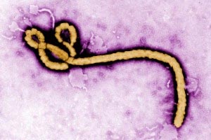 Ebola Virus Disease